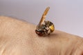 Hornet bites a manÃ¢â¬â¢s hand on a white background